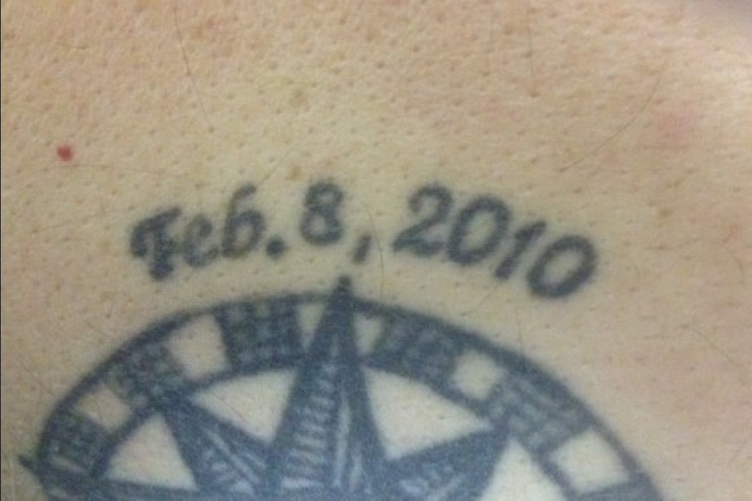Before and After Richmond, VA East Coast Laser Tattoo Removal